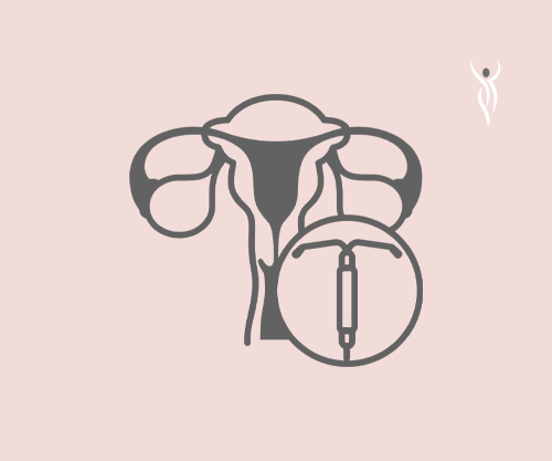 Expert Complex Coil Removal in Birmingham