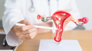 cervical polyp removal in Birmingham