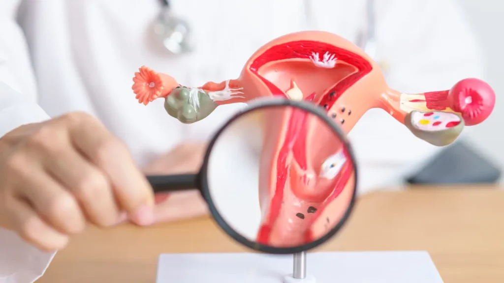 Magnifying glass focusing on a model of the uterus and ovaries