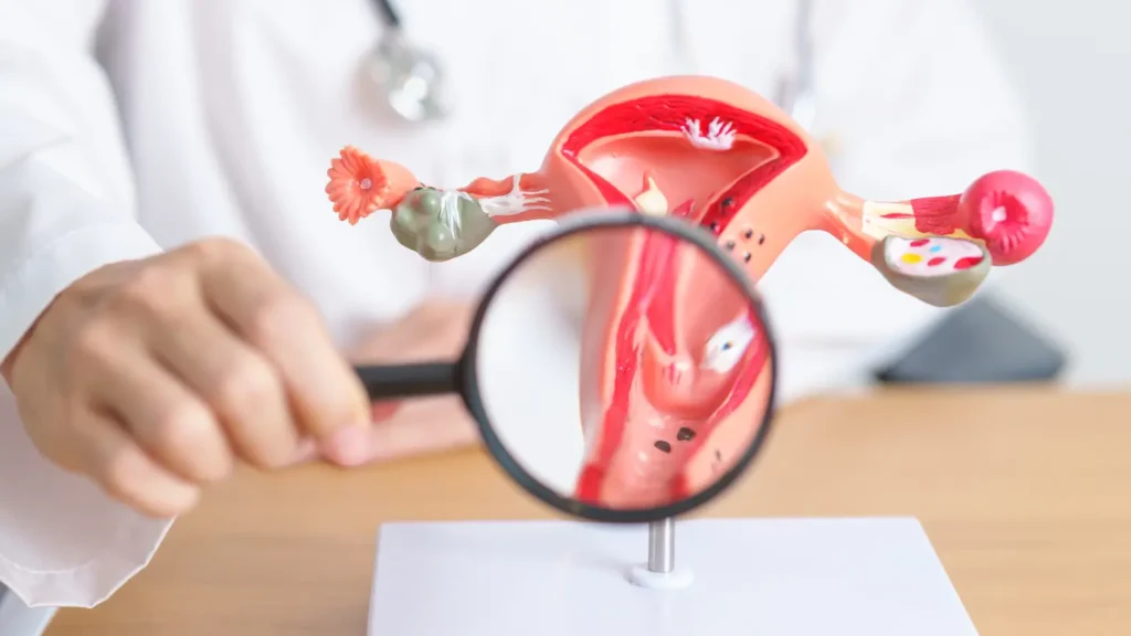 Laparoscopic hysterectomy in Birmingham performed using minimally invasive surgical technique