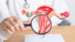 Laparoscopic hysterectomy in Birmingham performed using minimally invasive surgical technique