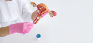 Wid Easy test for endometrial cancer demonstration with a gynecologist holding a uterus model and collecting a sample for diagnostic analysis